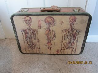 Oshkosh Skeliton Luggage Suitcase,  Trunk Very Rare Only 1 On Site 50s - 60s,  2 Keys