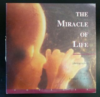 Videodiscovery The Miracle Of Life Science Education Laser Disc Rare Videodisc