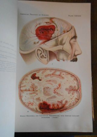 Rare Early Color Illustrated Medical Book Diseases Bone Disorders Head Trauma