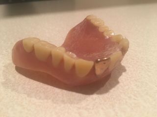 Freaky Rare Gold Tooth In Dentures Real Full Upper False Teeth Large